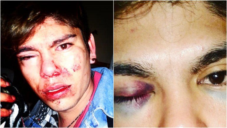 ConmociÃ³n: un joven fue golpeado brutalmente por ser gay